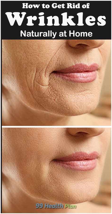 Aging Naturally: The Beauty of Wrinkles