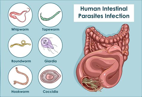 An Unsettling Phenomenon: Nighttime Visions of Intestinal Parasites