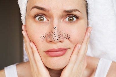 Breaking the Cycle: Effective Strategies for Preventing and Treating Blackheads