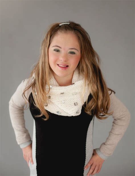 Celebrating Diversity: Embracing the Unique Beauty of Down Syndrome