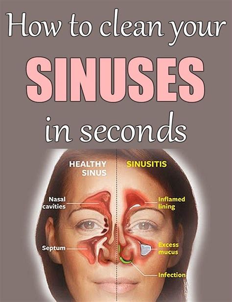 Clearing Your Nasal Passages Naturally: Effective Home Remedies and Techniques