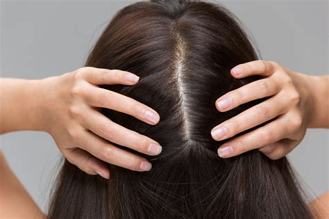 Common Treatments for Scalp Flake Management