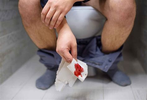 Dangers of Blood in Stool: Causes, Symptoms, and Treatment