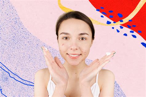 Debunking Popular Myths About Acne