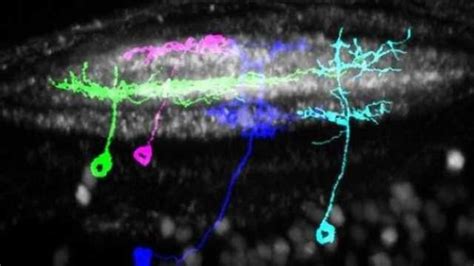 Deciphering the Role of Brain Activity in Frigid Reveries