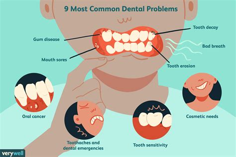 Dental Issues and Health Problems