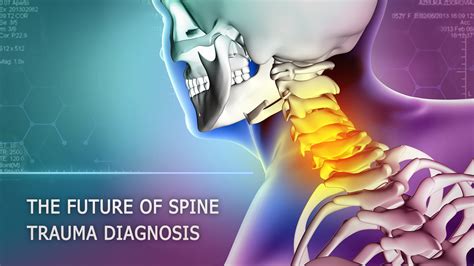 Diagnosis Techniques: Identifying Spinal Fractures