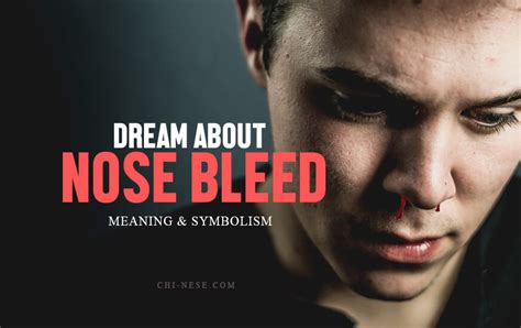 Dreaming of Nose Bleeding: An Unsettling Symbol