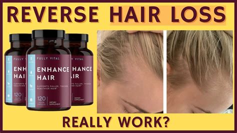 Enhance Hair Thickness with Supplements