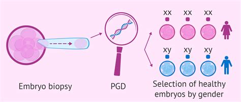 Exploring Different Approaches: Selecting the Appropriate Method for Gender Selection