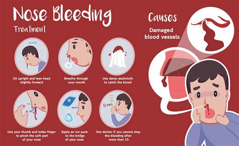 Exploring Different Interpretations of Epistaxis in Dreams