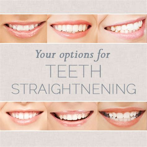 Exploring Different Options for Teeth Straightening