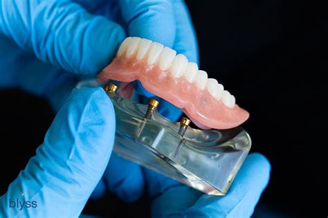 Exploring Possible Causes of Denture Dreams