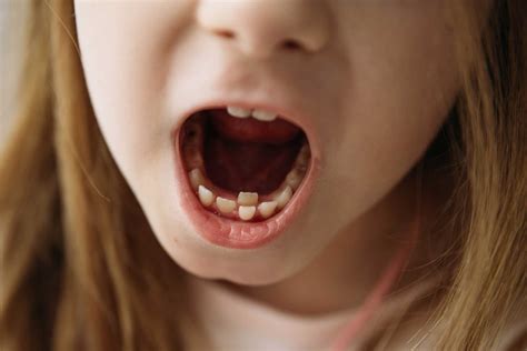 Exploring Symbolic Meanings: The Phenomenon of Growing or Shapeshifting Baby Teeth in Dreams