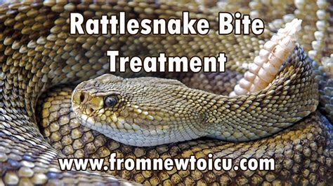 Exploring the Connection Between the Rattlesnake Bite Vision and Personal Relationships