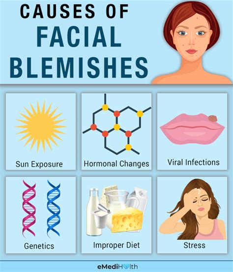 Exploring the Cultural and Historical Significance of Facial Blemishes