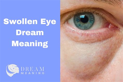 Exploring the Emotional and Spiritual Significance of a Swollen Eye Dream