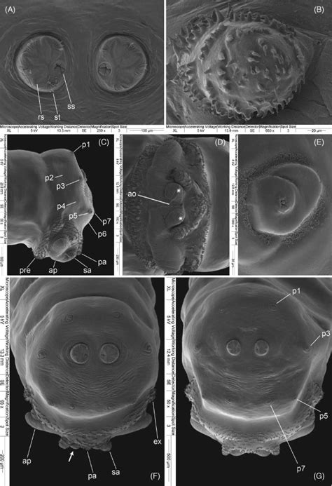 Exploring the Influence of Iconography Surrounding Supernumerary Papilla