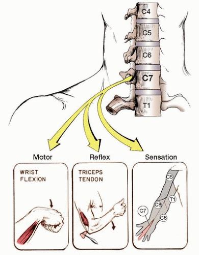 Exploring the Significance of Cutting Incidents Involving the Upper Limb