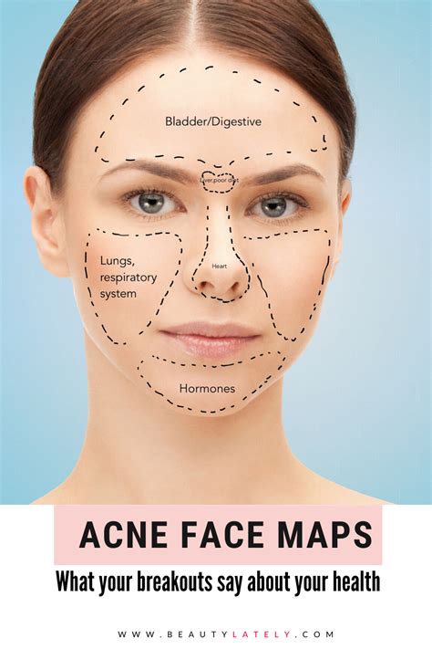 Exploring the Underlying Factors Behind the Occurrence of Acne Breakouts