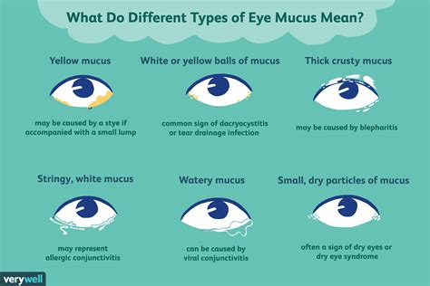 Exploring the Various Types of Ocular Secretions