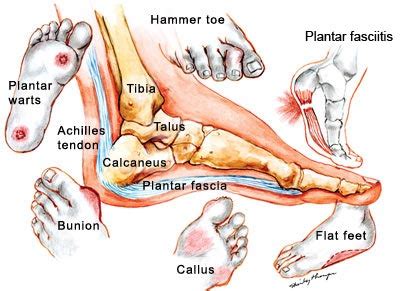 From Athlete's Foot to Plantar Fasciitis: Specific Feet Conditions and their Potential Symbolic Significance