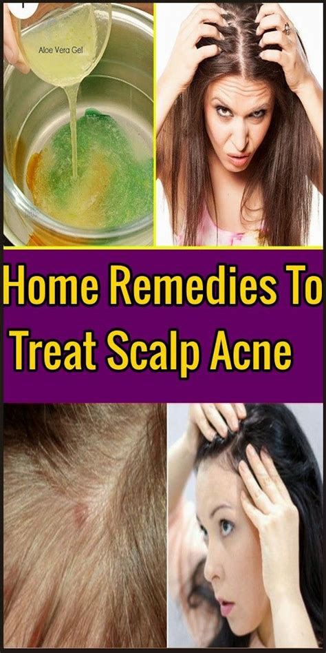 From Nightmares to Clear Skin: Tips to Prevent Pimples on the Scalp and Promote Overall Well-being