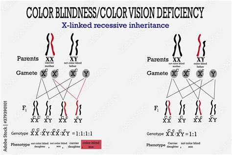 Genetics and Color Blindness: Unraveling the Role of Inherited Traits