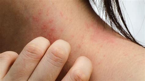 Identifying Skin Conditions that Cause Persistent Itching
