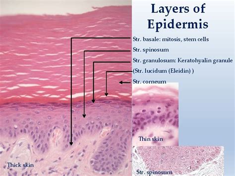 Insights for Decoding and Comprehending Your Vision of Growing Extra Mammary Appendages