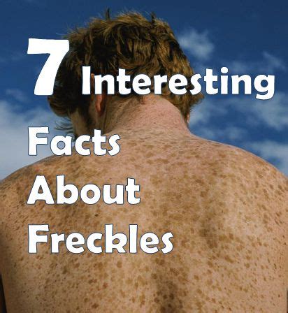 Interesting Insights Into Freckles' Life