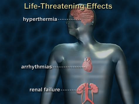 Life-Threatening Consequences