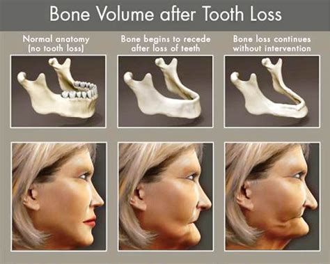 Losing Tooth Revealed