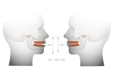 Measuring Eadie Sexwick's vertical dimension