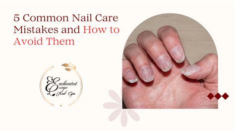 Nail Care Mistakes to Avoid: Common Pitfalls and How to Overcome Them