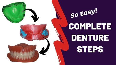 Practical Steps to Manage Denture-Related Nightmares