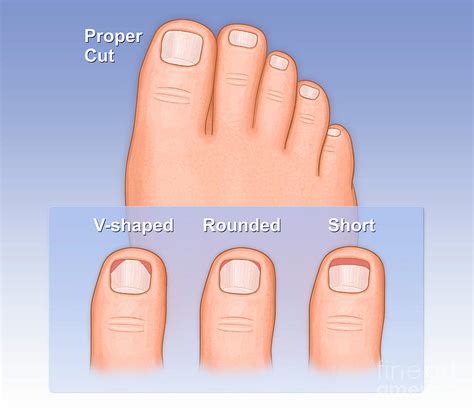 Proper Techniques for Trimming and Maintaining Excessively Lengthy Nails