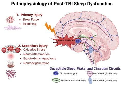 Psychological Factors Influencing Dreams of a Child Sustaining Injuries