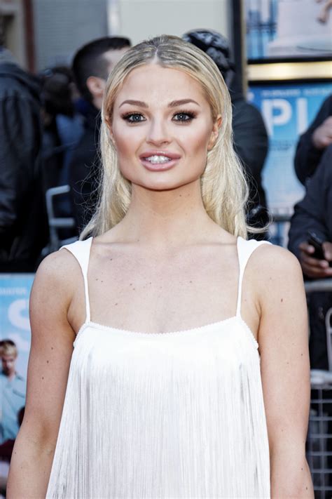 Recognition of Emma Rigby's talent in the entertainment industry