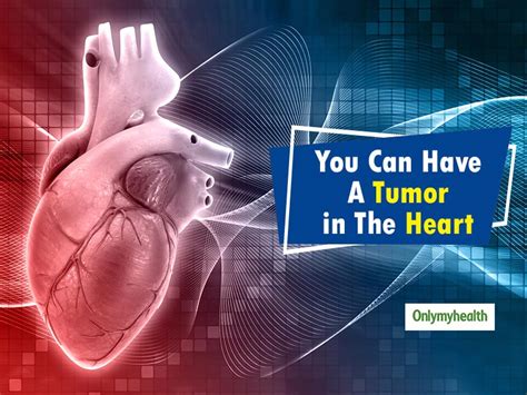 Recognizing Early Signs of Cardiac Tumor: Early Indicators not to Ignore