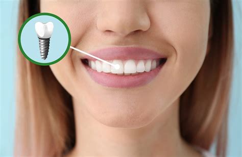 Restoring Confidence and Improving Oral Health: How Dental Implants Can Transform Your Smile