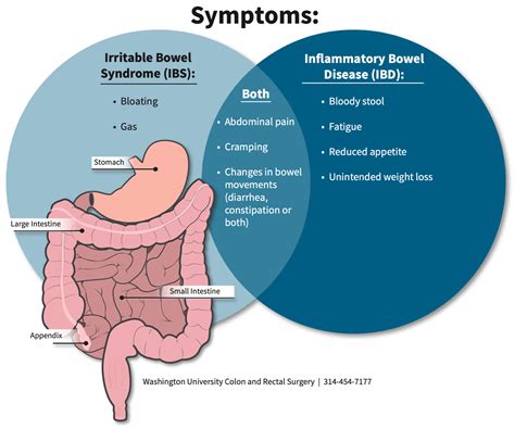 Seek Medical Assistance for Bowel Concerns