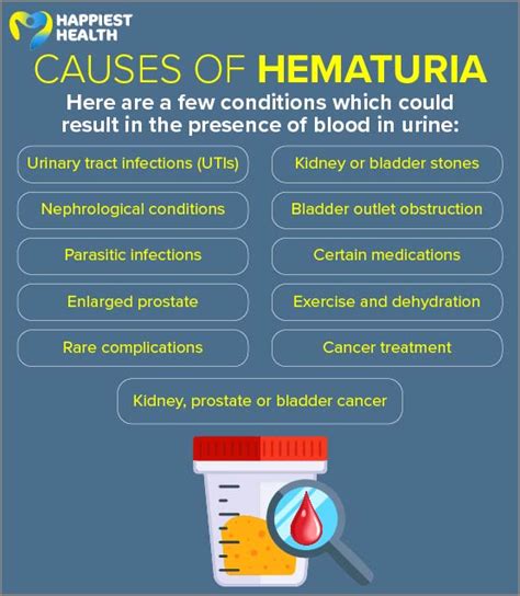 Seeking Relief: Treatments for Hematuria