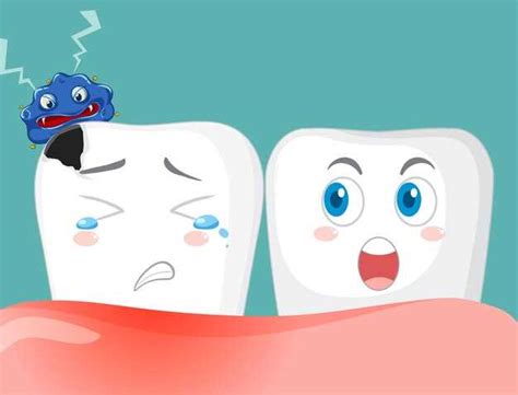 Significance of Tooth Fracture In Dreams: Exploring its Impact on Personal Life