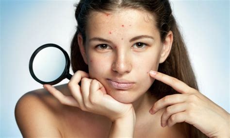Smart Ways to Handle Blemishes on Your Facial Skin in Real Life