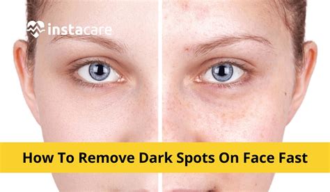 Steps to Take If Having Concerns About Health When Dreaming of Dark Spots on the Skin