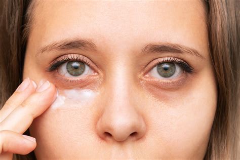 Sunken Eyes and Aging: Is It a Natural Process or a Sign of Underlying Health Issues?