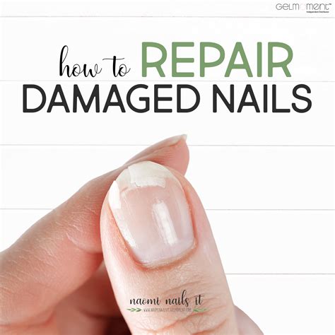 Taking Care of Damaged Nails: DIY Methods and Expert Treatments