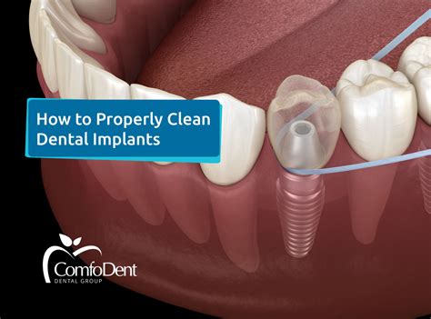 Techniques for Achieving Optimal Dental Hygiene