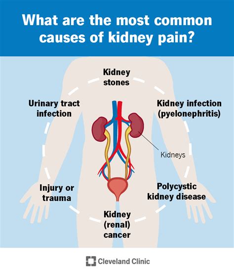 The Connection Between Kidney Discomfort and Health Conditions